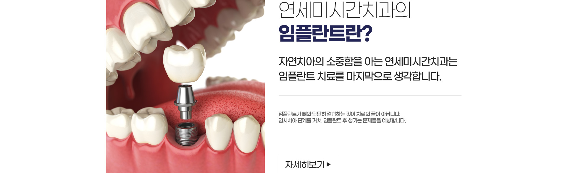 �����̽ð����� ���ö�Ʈ