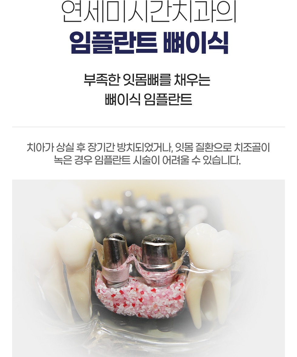 ���ö�Ʈ ���̽�