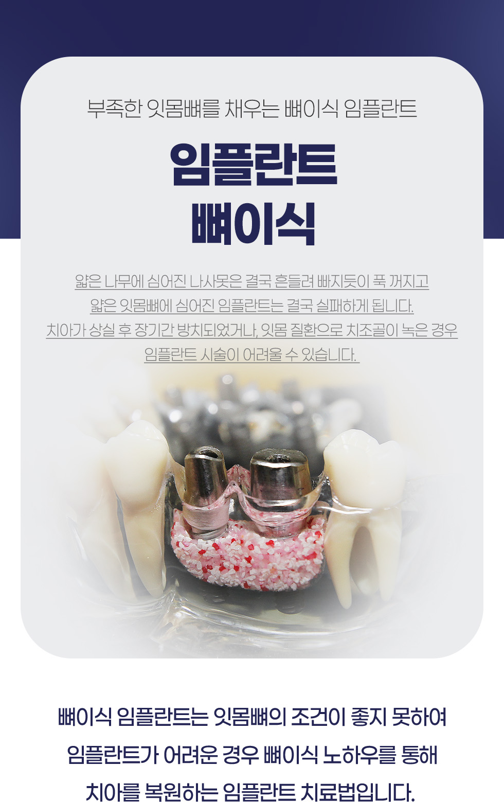 ���ö�Ʈ ���̽�