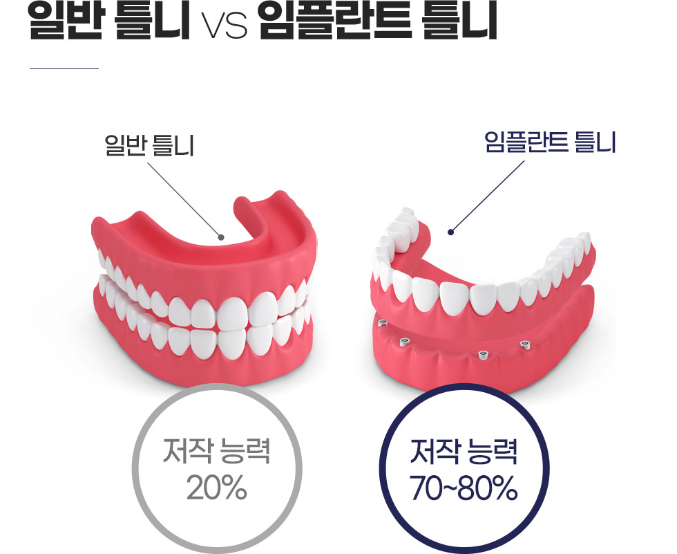 �Ϲ� ���ö�Ʈ�� �׺���̼� ���ö�Ʈ ��