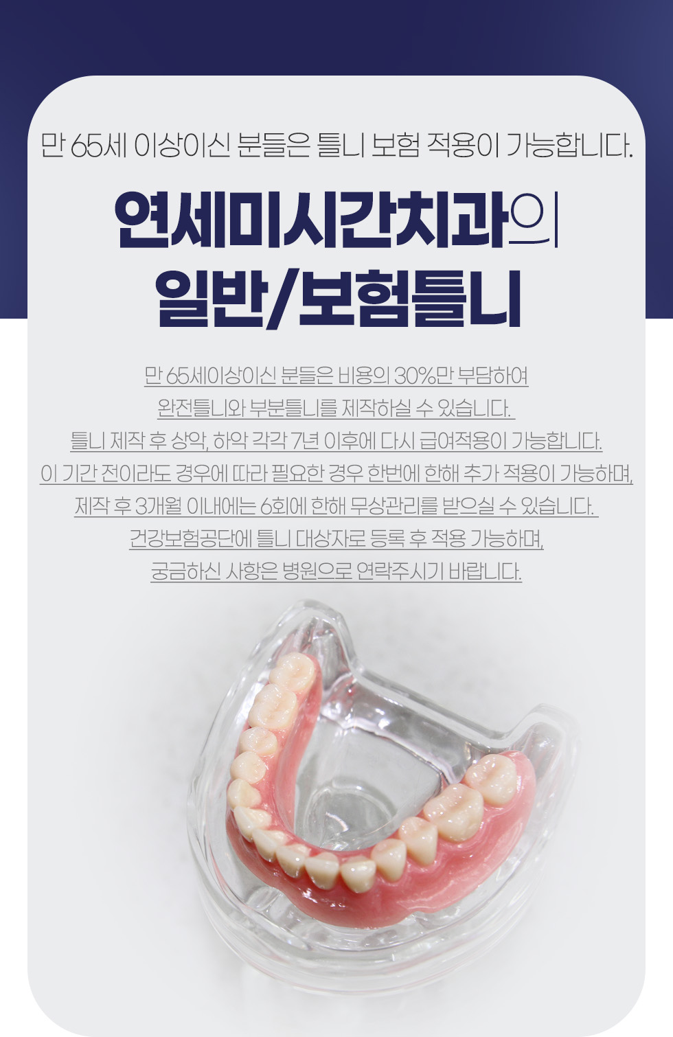 �����̽ð�ġ���� �Ϲ�/����Ʋ��