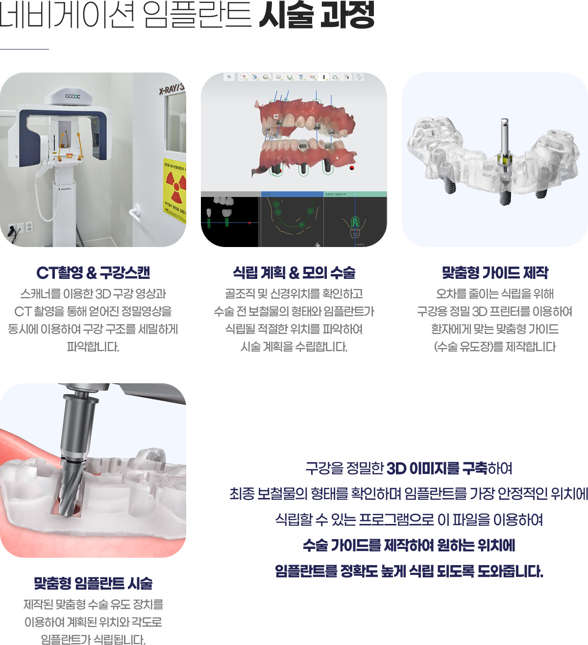 �׺���̼� ���ö�Ʈ �ü� ����