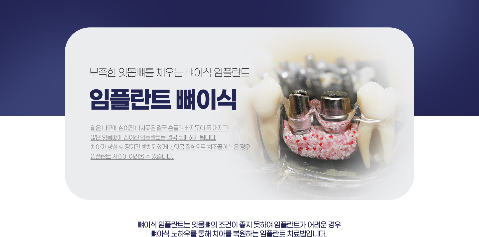 ���ö�Ʈ ���̽�