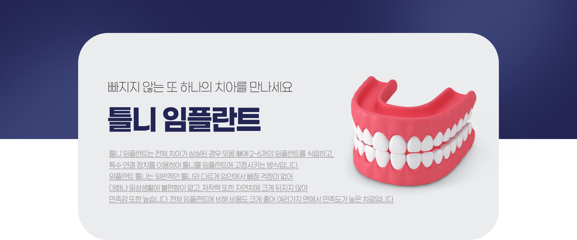 �׺���̼� ���ö�Ʈ ����