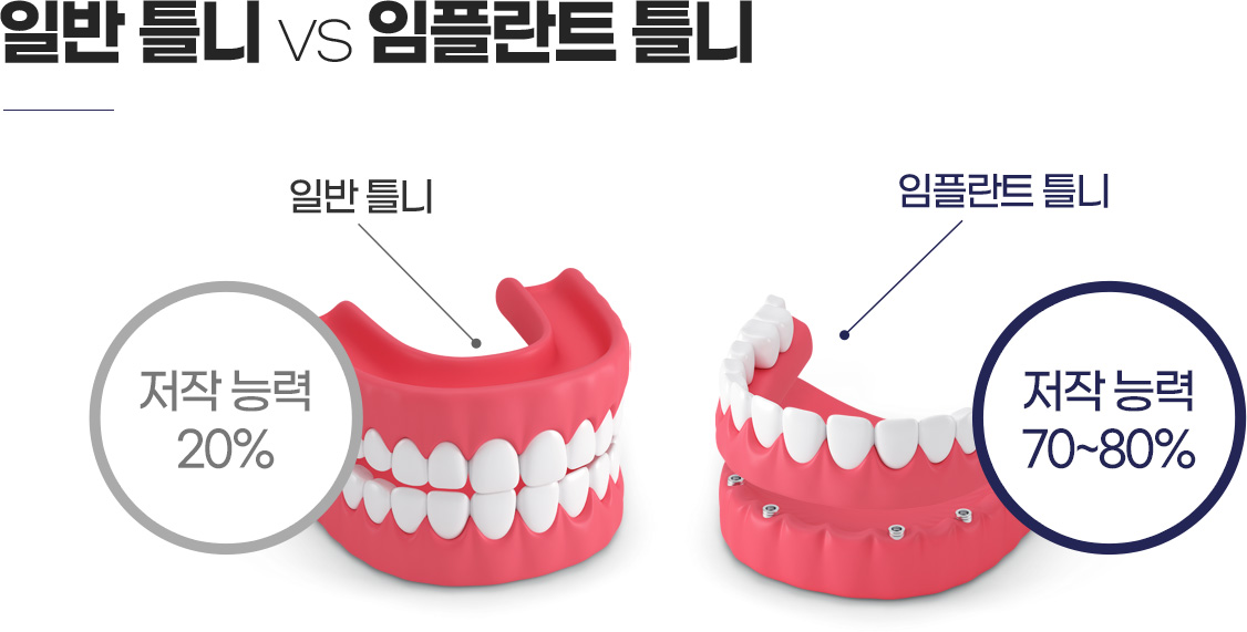 �Ϲ� ���ö�Ʈ�� �׺���̼� ���ö�Ʈ ��