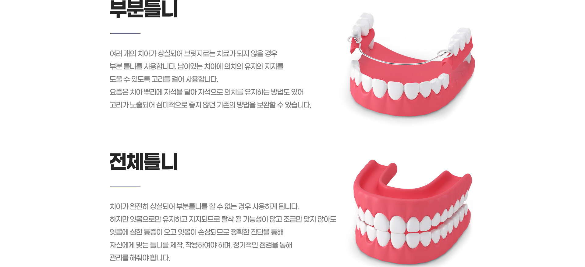 �κ�Ʋ��/��üƲ��